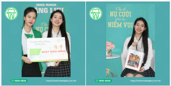 Anh Thư - Tân tháo niềng-er xinh xắn thuộc nhà Nha khoa Đăng Lưu vô cùng rạng rỡ trong ngày "Tốt Nghiệp Niềng Răng" của chính mình.