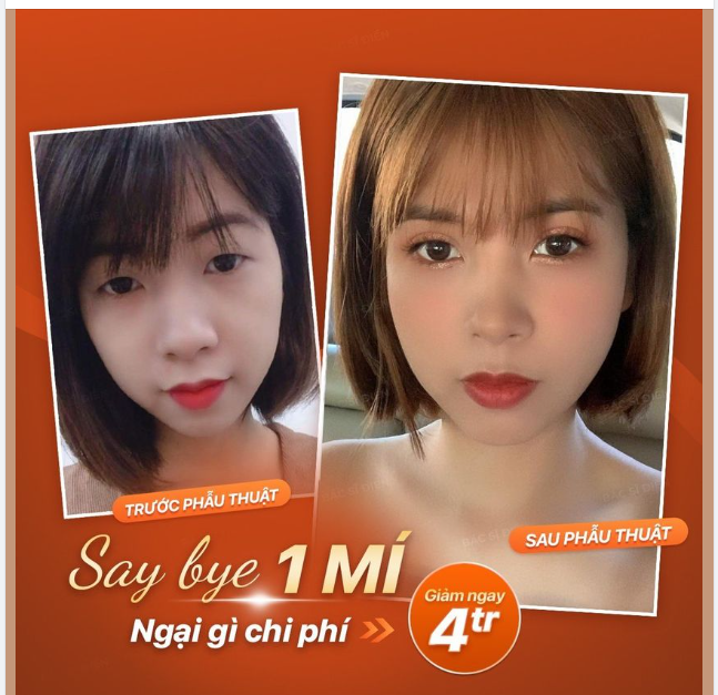 "SAY BYE" 1 MÍ - NGẠI GÌ CHI PHÍ