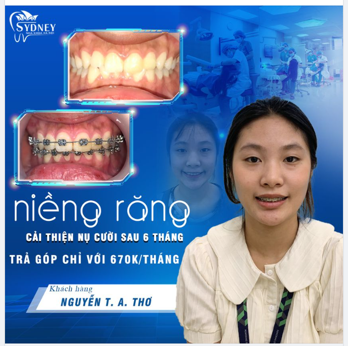 CHÀO THÁNG 8 – SÁNG NỤ CƯỜI XINH VỚI NGẬP TRÀN ƯU ĐÃI