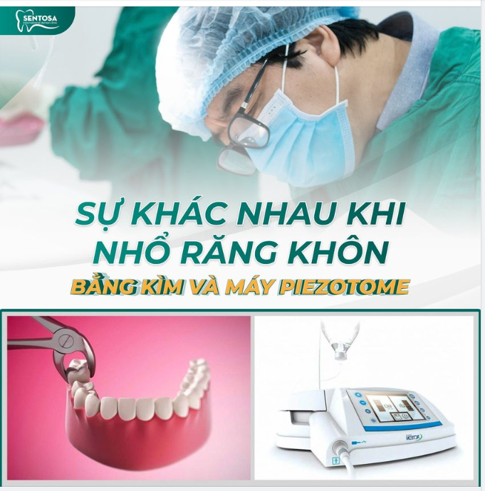 SỰ KHÁC NHAU KHI NHỔ RĂNG KHÔN BẰNG KÌM VÀ MÁY PIEZOTOME