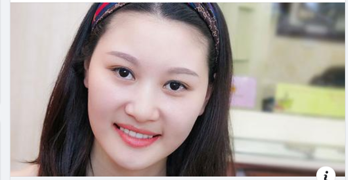 Sau khi tẩy trắng răng cần tuân thủ