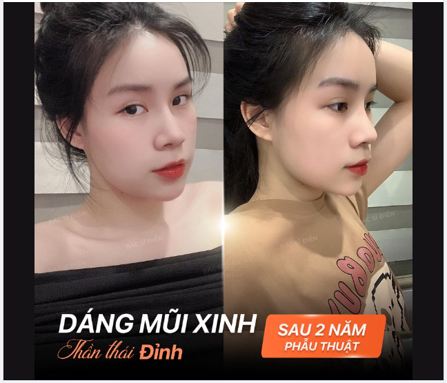 DÁNG MŨI XINH - THẦN THÁI ĐỈNH