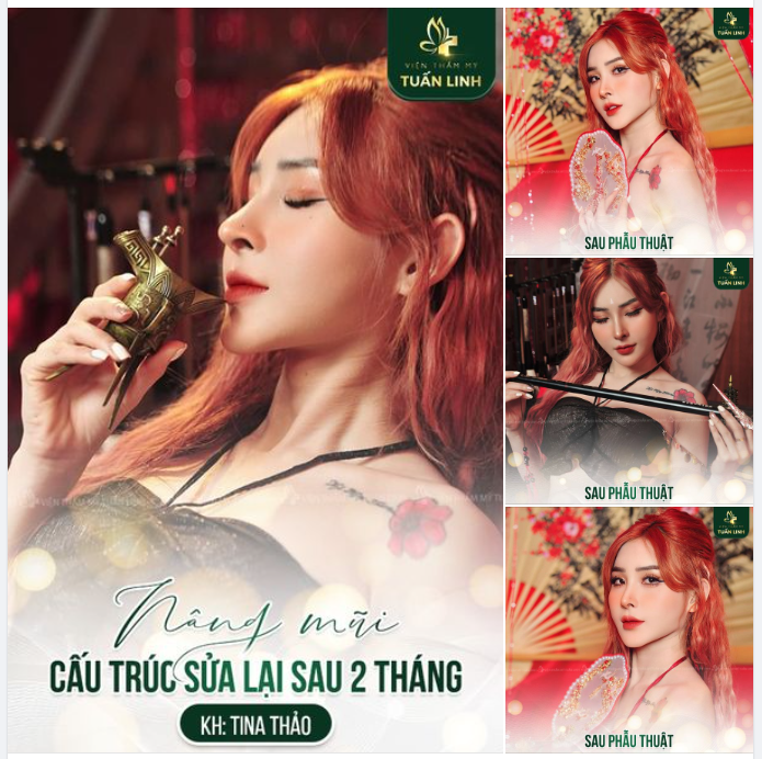 Mỹ nhân nhà Tuấn Linh với chiếc mũi đẹp hoàn hảo sau 2 tháng sửa lại 