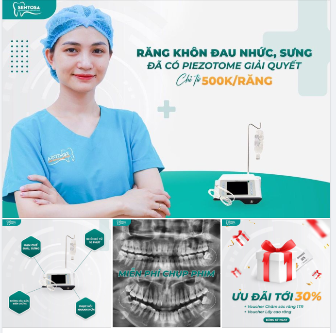 RĂNG KHÔN ĐAU NHỨC, SƯNG, CHẢY MÁU