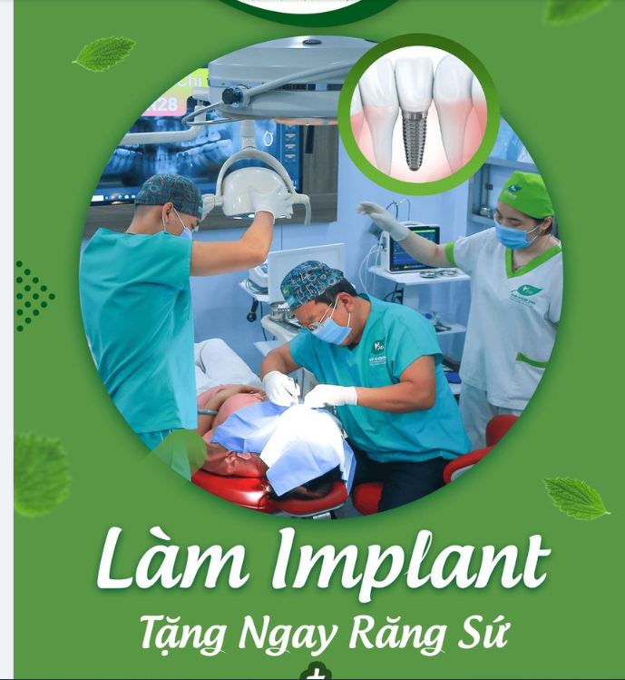 ƯU ĐÃI CẮM GHÉP RĂNG IMPLANT 