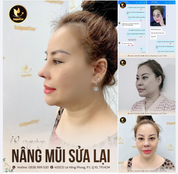 ƯNG QUÁ CHỪNG DÁNG MŨI 10 NGÀY TUỔI