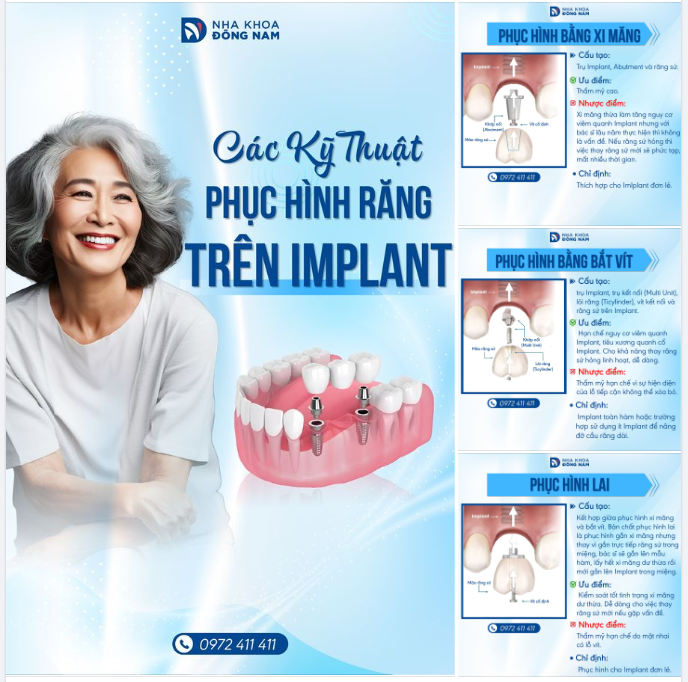 Phục hình răng trên Implant bằng xi măng hay bằng vít đã tạo ra cuộc tranh luận không hề nhỏ.