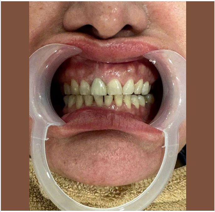 KHÁM RĂNG ĐỊNH KỲ VÀ NHỮNG LỢI ÍCH BẤT NGỜ