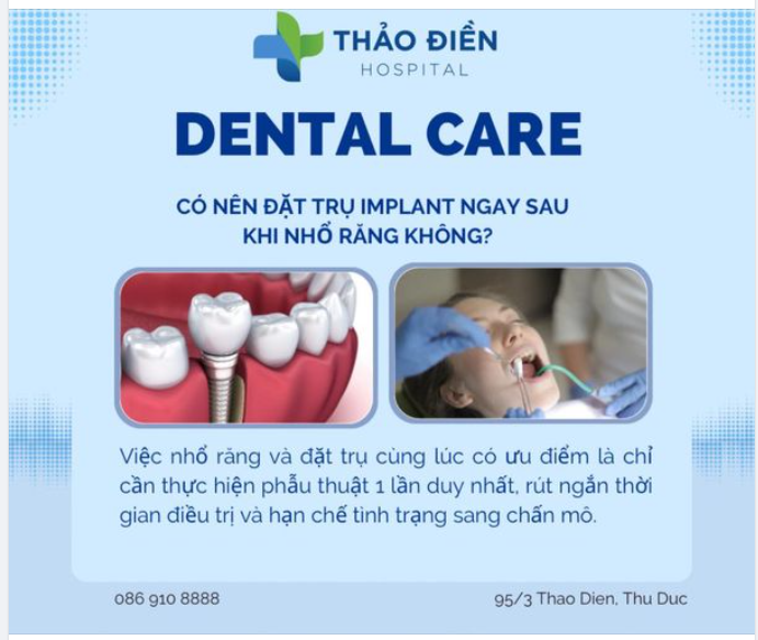 CÓ NÊN ĐẶT TRỤ IMPLANT SAU KHI NHỔ RĂNG KHÔN?