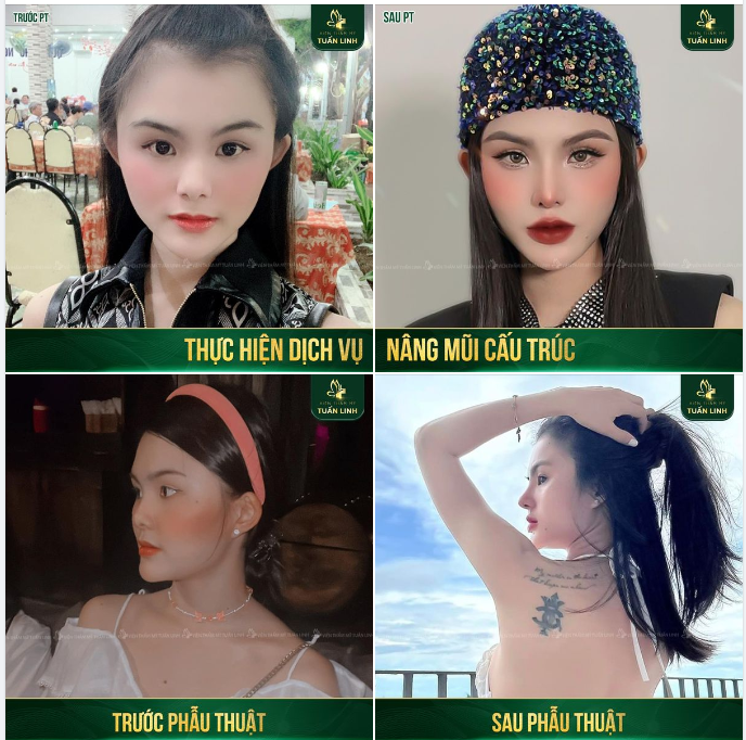 Xinh đẹp là đặc quyền của phụ nữ!! Bạn có dám vượt qua rào cản để sở hữu nhan sắc vạn người mê không?