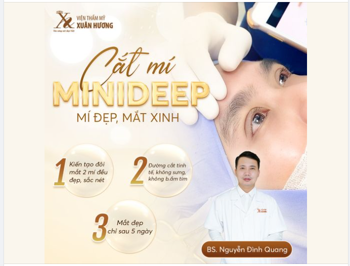 CẮT MÍ MINI DEEP - GIẢI PHÁP “VÀNG” CHO ĐÔI MẮT TRẺ TRUNG, SẮC NÉT