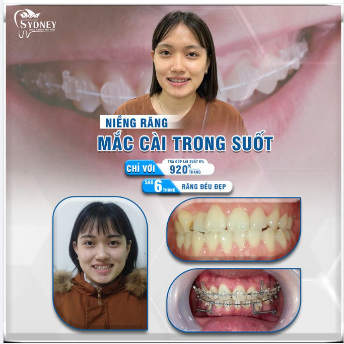 NỤ CƯỜI RẠNG RỠ - RỘNG MỞ TƯƠNG LAI