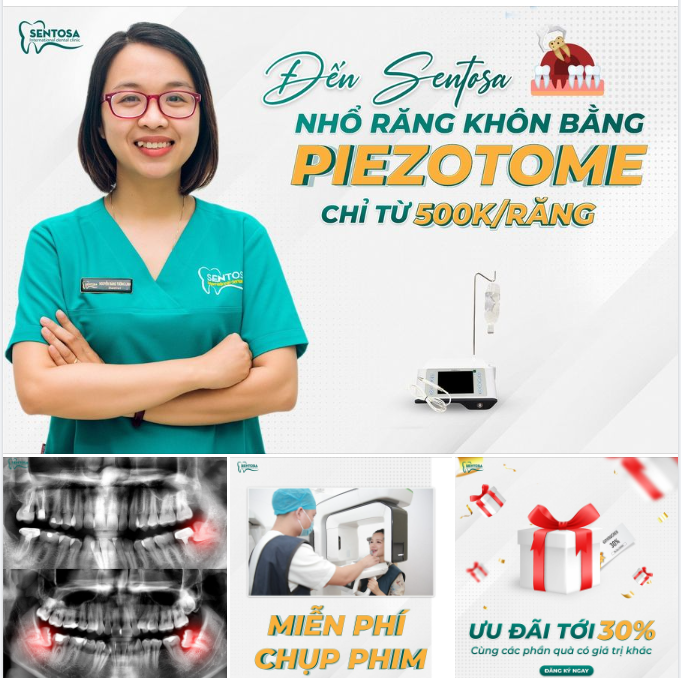 ĐẾN SENTOSA NHỔ RĂNG KHÔN BẰNG PIEZOTOME CHỈ TỪ 500K/RĂNG