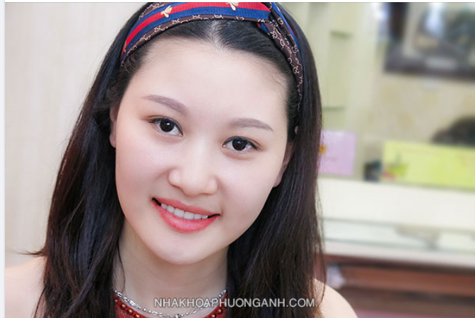 Những điều đơn giản để con có hàm răng đẹp ngay từ bé