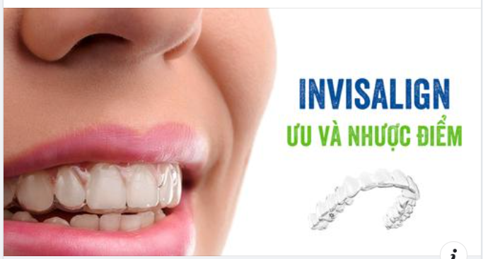 Niềng Răng Bằng Invisalign So Với Niềng Răng Truyền Thống