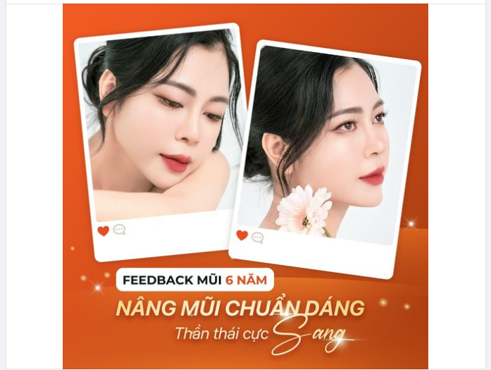 NÂNG MŨI CHUẨN DÁNG - THẦN THÁI CỰC SANG