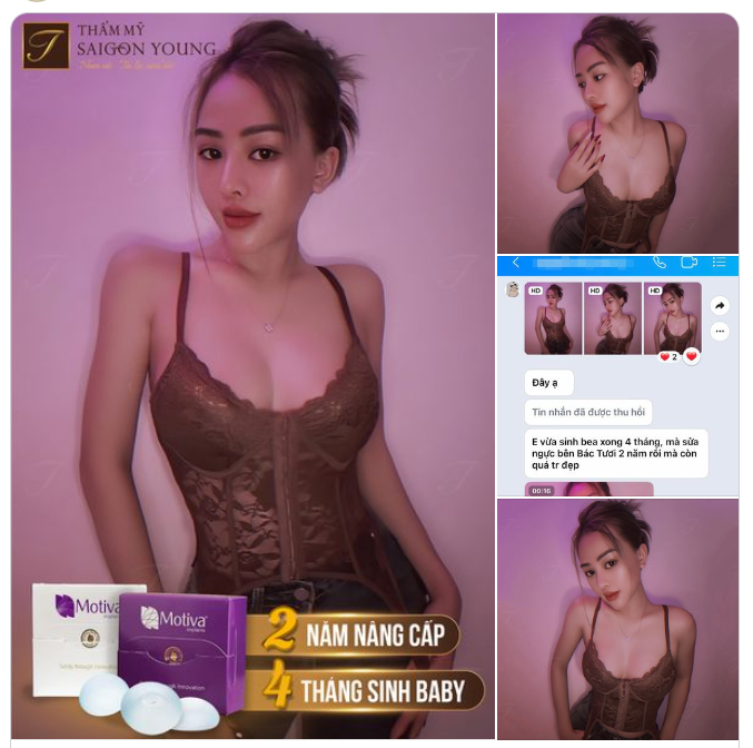 Nhìn như thế này chắc chị em cũng không đoán được đây là kết quả sau 2 năm nâng cấp tại Saigon Young