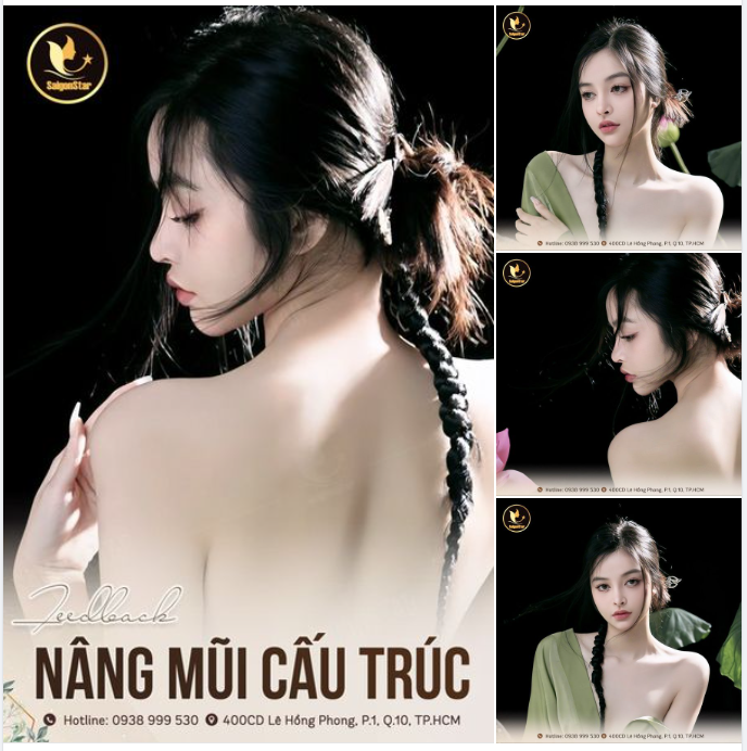 FEEDBACK “XINH XỈU” SAU 1 NĂM NÂNG MŨI