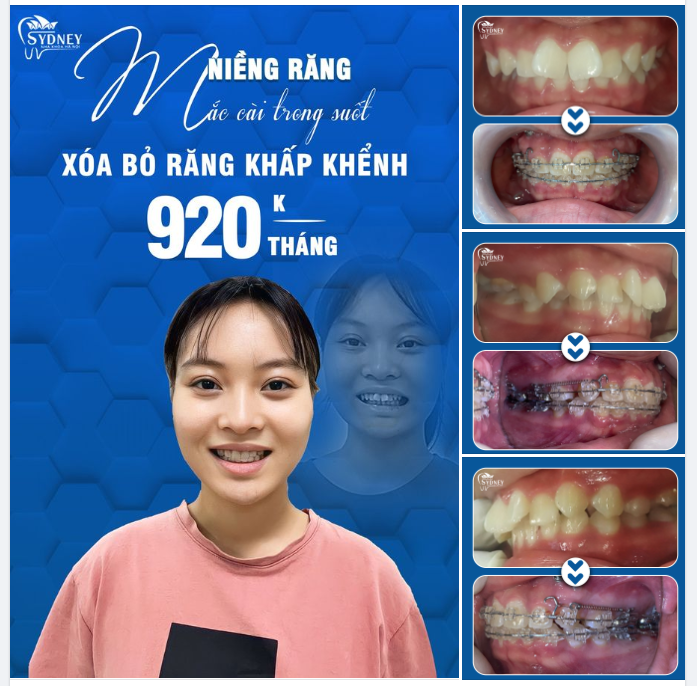 NỤ CƯỜI CỦA KHÁCH HÀNG – NIỀM VUI CỦA NHA KHOA HÀ NỘI SYDNEY