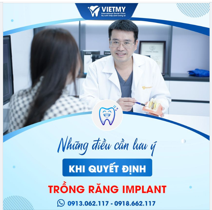 Những Điều Cần Lưu Ý Trước Khi Trồng Răng Implant