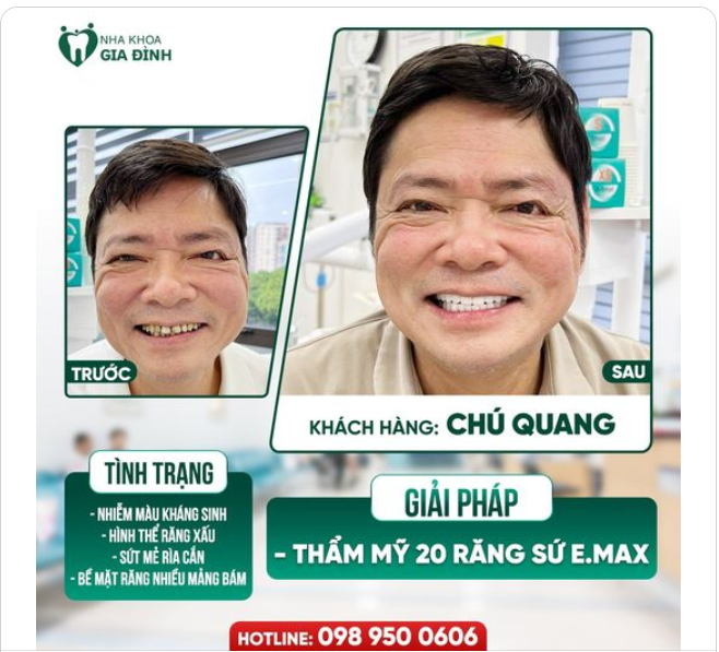 HÀM RĂNG VÀ NỤ CƯỜI CÓ KHỎE ĐẸP THÌ CUỘC SỐNG MỚI TRỌN VẸN Ý NGHĨA