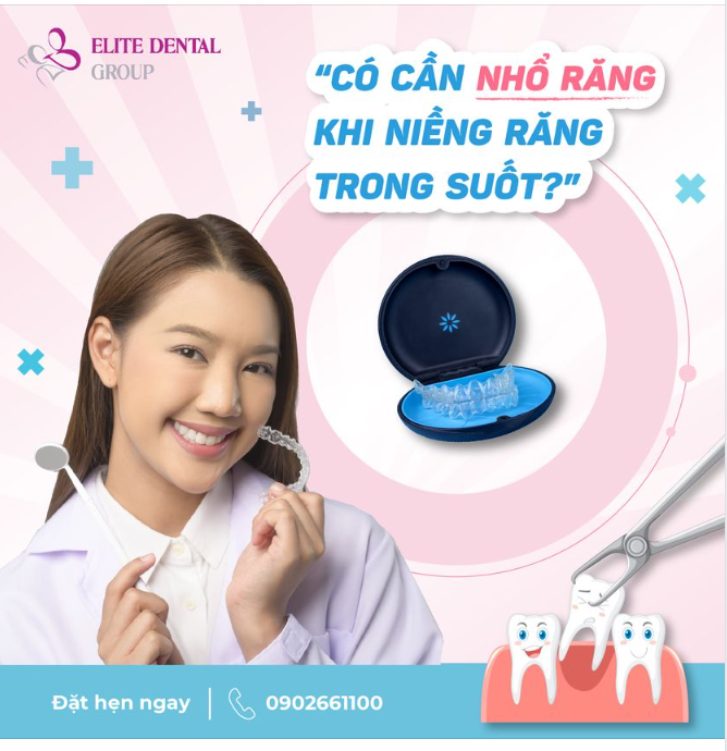 NIỀNG RĂNG TRONG SUỐT CÓ PHẢI NHỔ RĂNG?