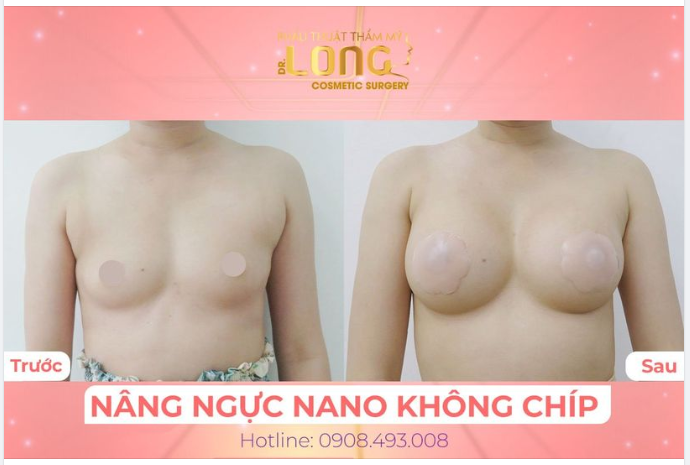 CAM CHANH HÓA BƯỞI XANH NHẬN NHANH “%” ƯU ĐÃI