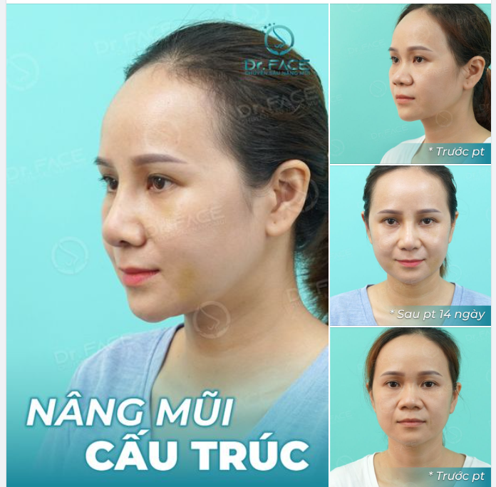 Đủ nắng hoa sẽ nở. Đủ mạnh mẽ mũi xinh sẽ thuộc về mình!