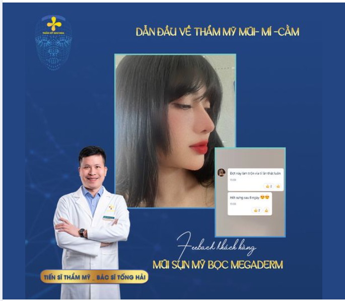 NÂNG MŨI SỤN MỸ - TẠM BIỆT KHUYẾT ĐIỂM
