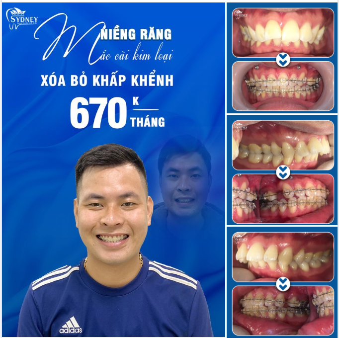 CHÀO THÁNG MỚI VỚI NỤ CƯỜI MỚI