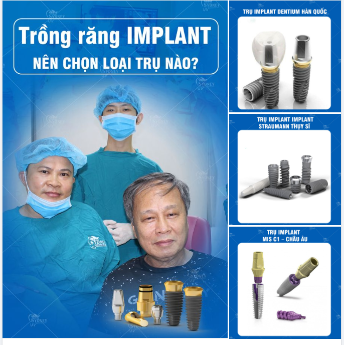 TRỒNG RĂNG IMPLANT LOẠI NÀO TỐT NHẤT?