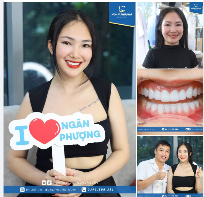 Cảm ơn Xuân Mộc đã tin tưởng bác sĩ Tuấn và Nha khoa Ngân Phượng