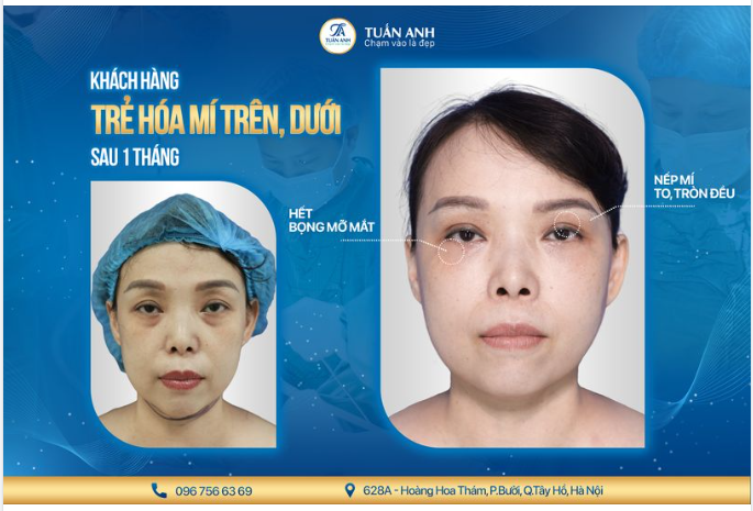 NỖI SỢ KHI ĐI LÀM ĐẸP CỦA CHỊ EM LÀ GÌ?