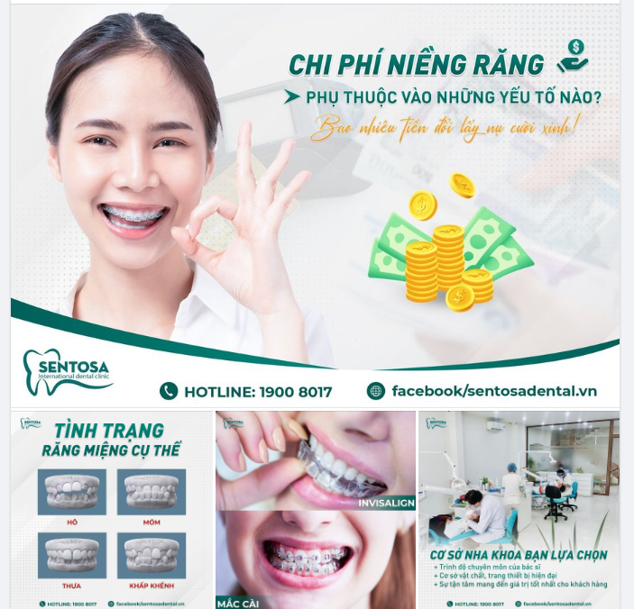 NIỀNG RĂNG CÓ THỰC SỰ TỐN KÉM NHƯ BẠN NGHĨ?