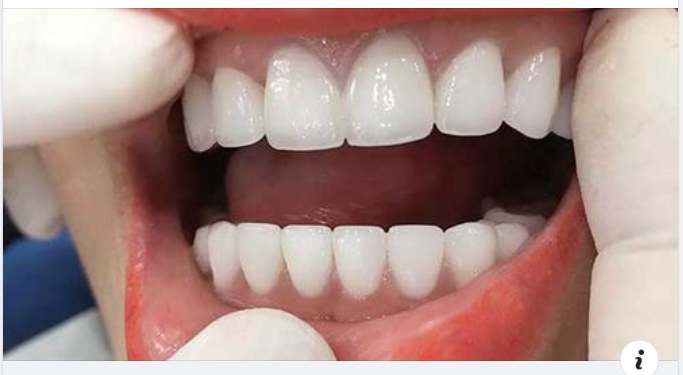 10 sự thật thú vị về răng miệng