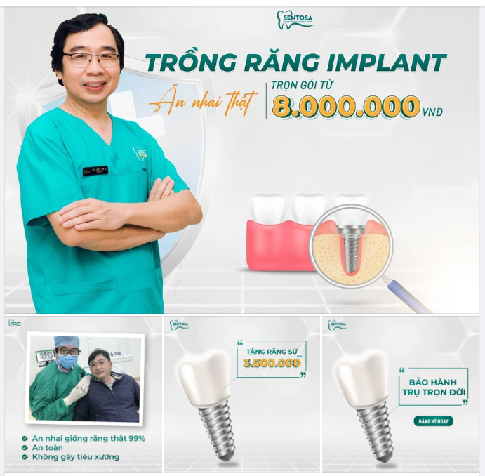 TRỒNG RĂNG IMPLANT ĂN NHAI THẬT TRỌN GÓI TỪ 8.000.000đ