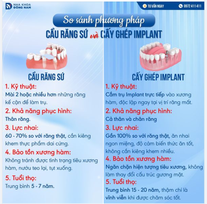 BÂY GIỜ RẤT ÍT NGƯỜI LÀM CẦU RĂNG SỨ, VỪA TIÊU XƯƠNG LẠI HẠI RĂNG THẬT. CẤY IMPLANT MỚI LÀ TỐI ƯU CẢ VỀ ĐỘ AN TOÀN, HIỆU QUẢ LẪN TIẾT KIỆM CHI PHÍ.