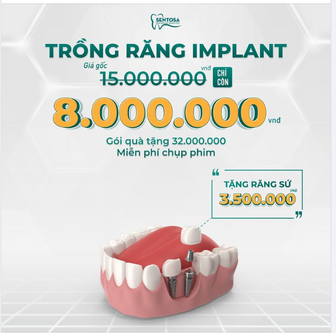 TRỒNG IMPLANT DIO HÀN QUỐC, KHÔNG ĐAU, ĂN NHAI NGAY