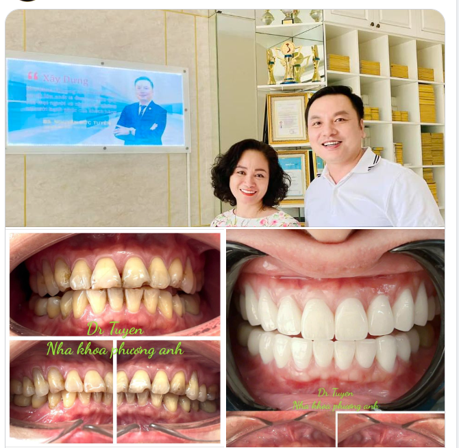 Đăng cái ảnh để bà con biết hàng ngày em vẫn trực tiếp làm chuyên môn ạ