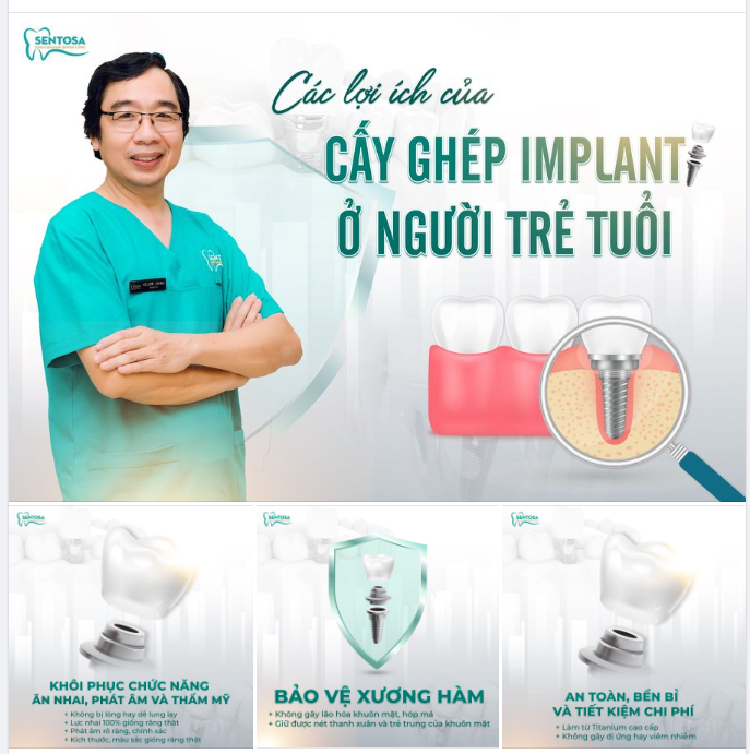 CÁC LỢI ÍCH CỦA CẤY GHÉP IMPLANT Ở NGƯỜI TRẺ TUỔI