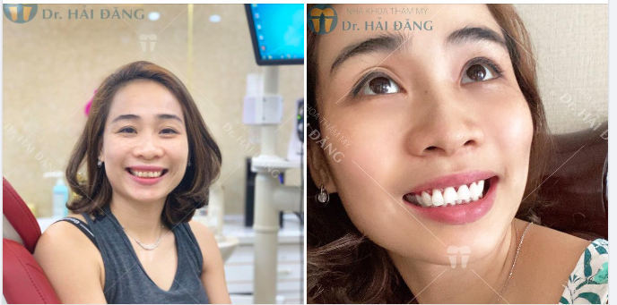 HÃY ĐỂ NỤ CƯỜI CỦA BẠN TRỞ NÊN TỰ TIN KHI GIAO TIẾP