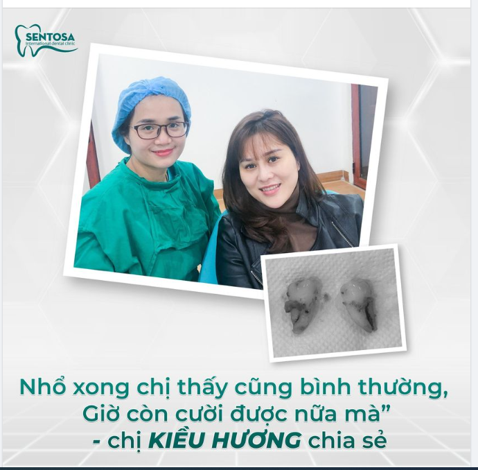 RĂNG KHÔN MỌC LỆCH CHẲNG CÒN LO VÌ CÓ PIEZOTOME