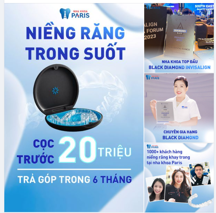 Niềng Răng Invisalign chỉ từ 20 Triệu đầu tiên và trả góp tiếp trong 6 tháng