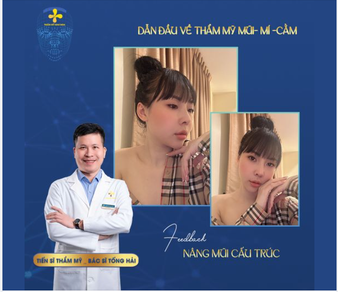 DÁNG MŨI KIẾN TẠO 70% NHAN SẮC GƯƠNG MẶT