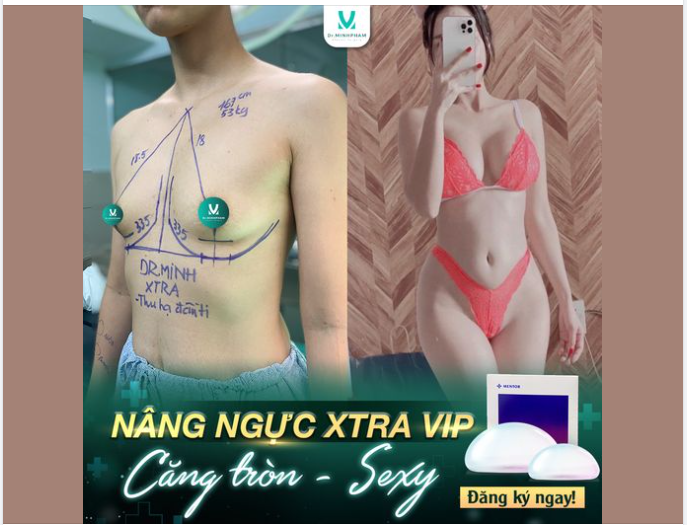 CÒN GÌ THÍCH HƠN NÂNG XONG MỀM NGAY