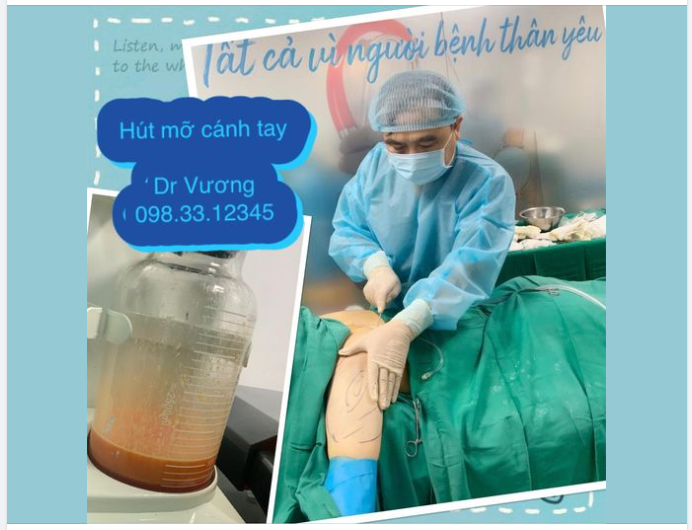 Hút mỡ cánh tay cho bạn gái Đà Nẵng