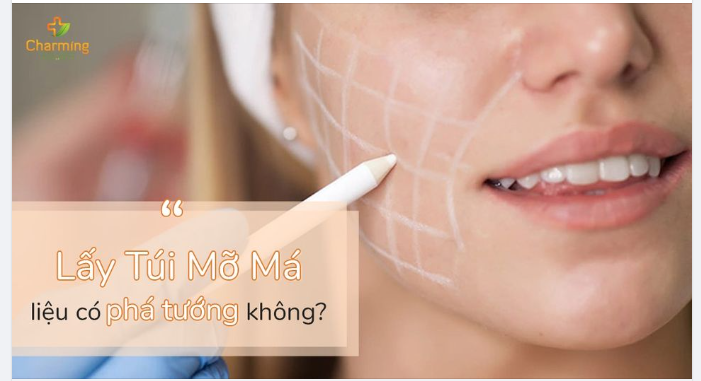 PHẪU THUẬT LẤY MỠ MÁ LIỆU CÓ PHÁ ĐI TƯỚNG PHÚ QUÝ?
