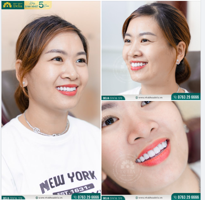 Mỉm cười là cách thức đơn giản và hiệu quả để giúp tinh thần của chúng ta luôn tươi mới, tích cực, cũng là sợi dây vô hình để kết nối yêu thương