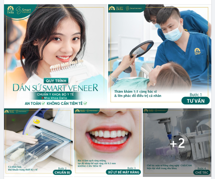 Khi bộ Smart Veneer được chế tác xong sẽ được đóng hộp riêng cùng chất gắn và chuyển tới phòng nha.