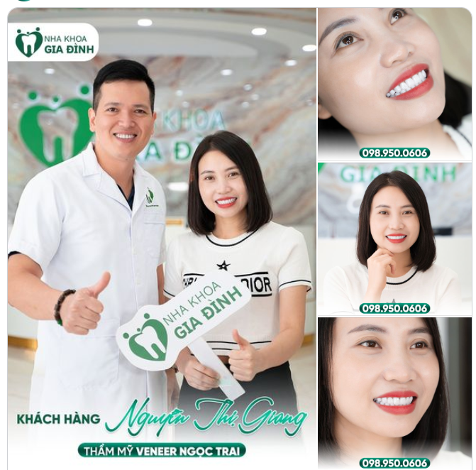 CHỊ GÁI HẠ LONG TRỞ LẠI ĐẦY TỰ TIN, RẠNG NGỜI SAU 1 NĂM THẨM MỸ RĂNG SỨ